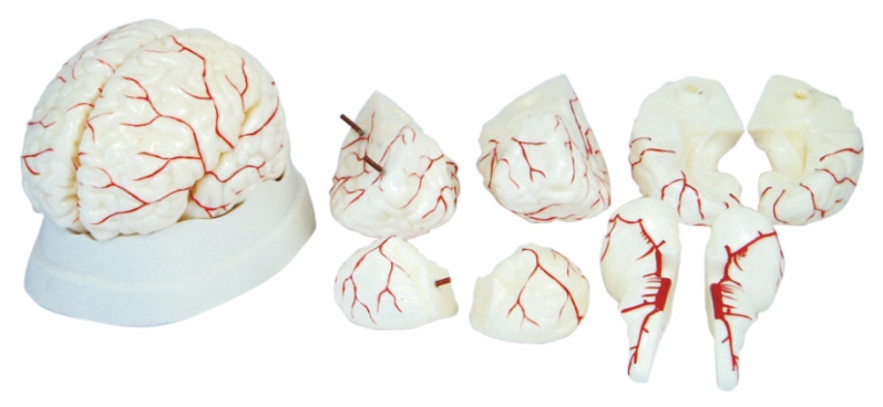 brain-with-arteries